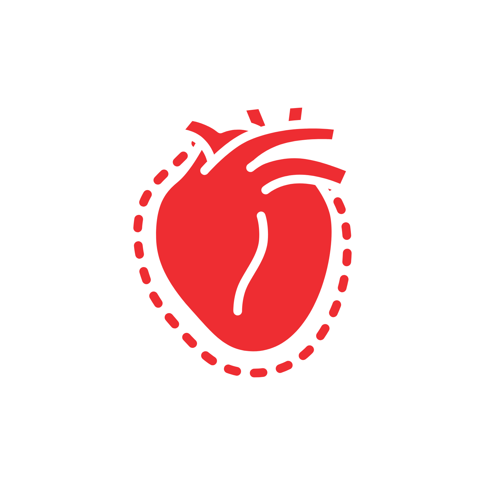 Enlarged Heart Chambers