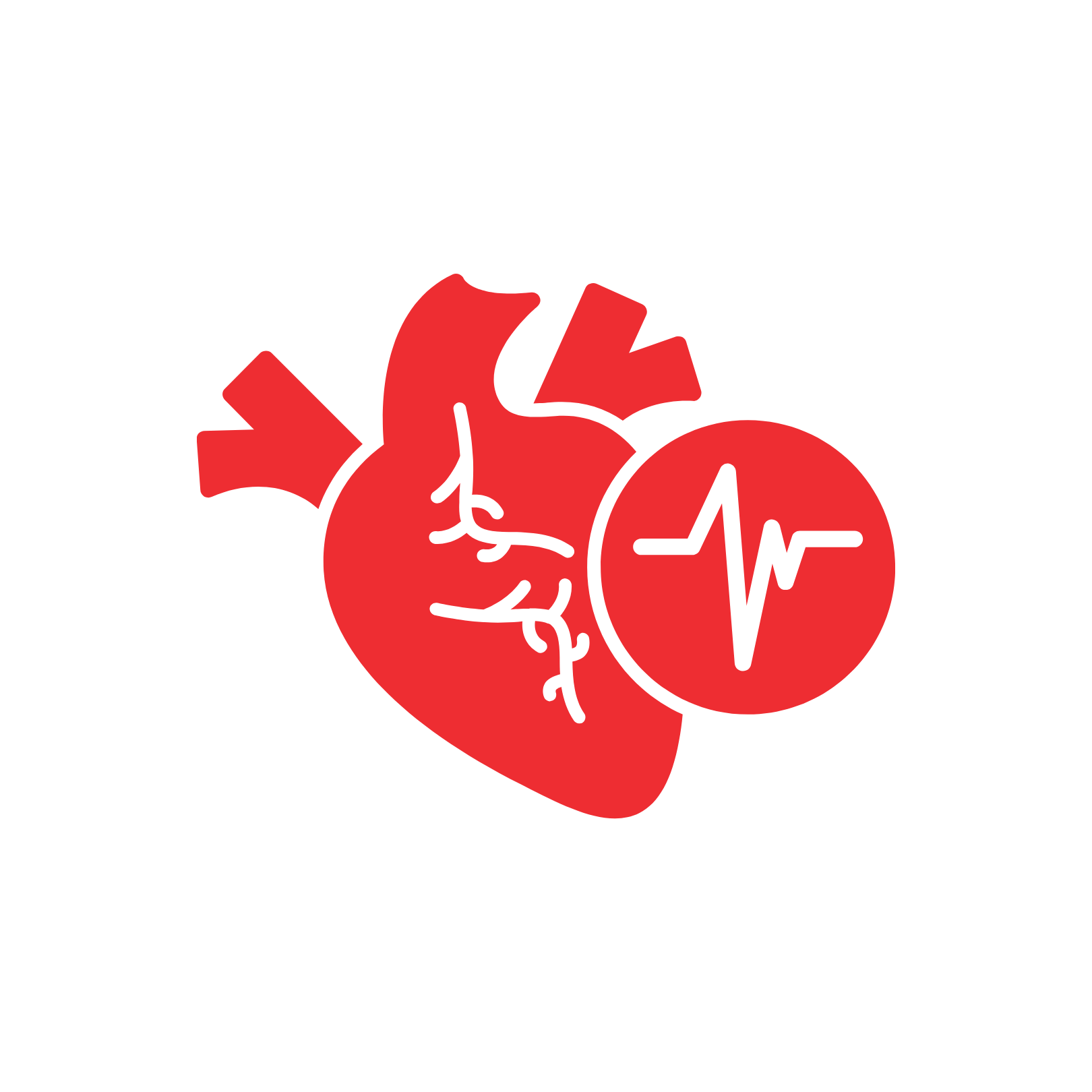 Atrial Fibrillation (AFib)