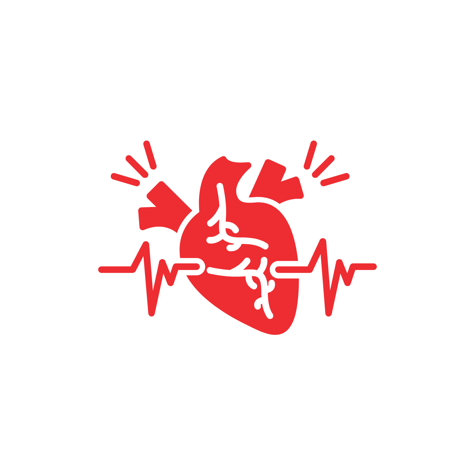 Atrial Flutter