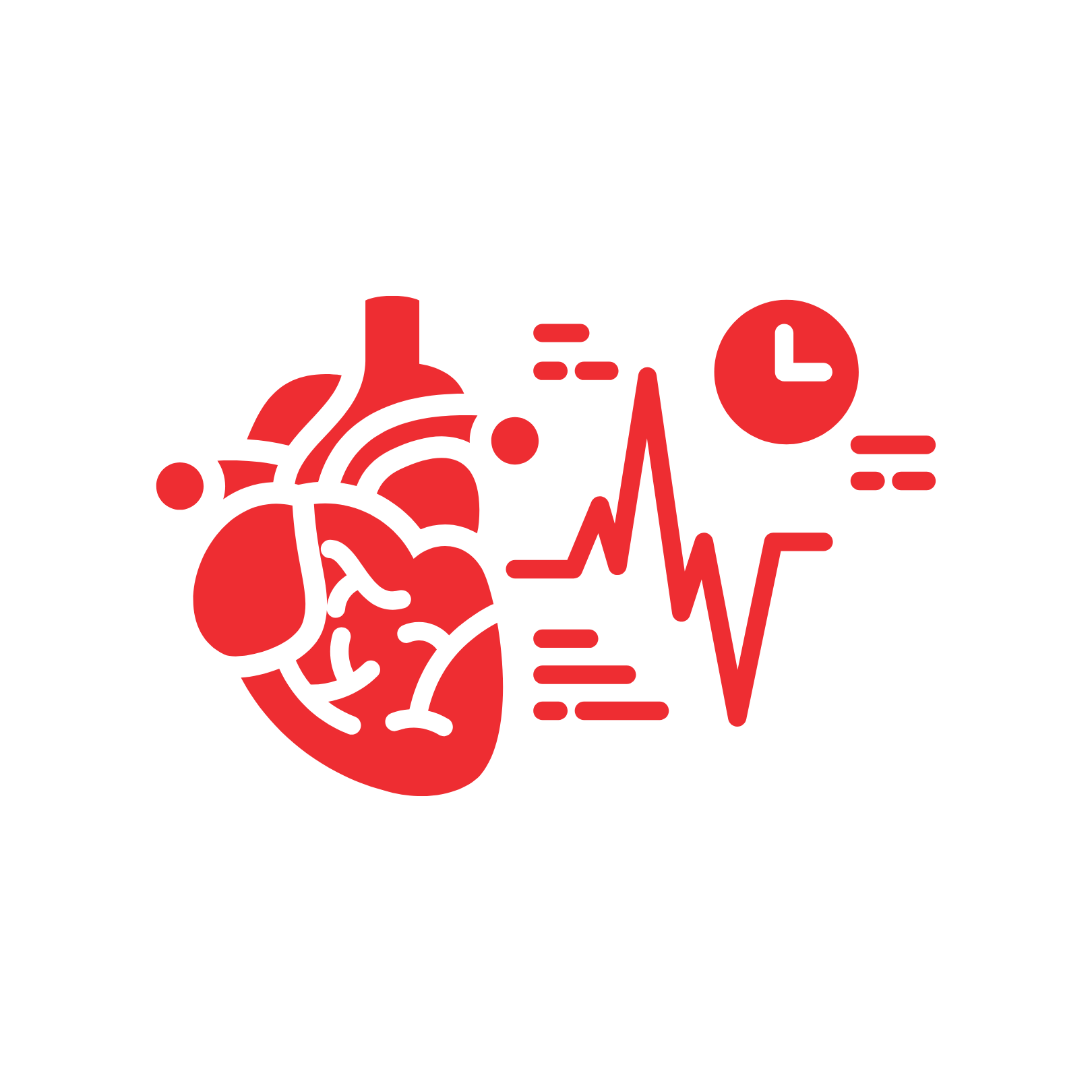 Captures Intermittent Arrhythmias