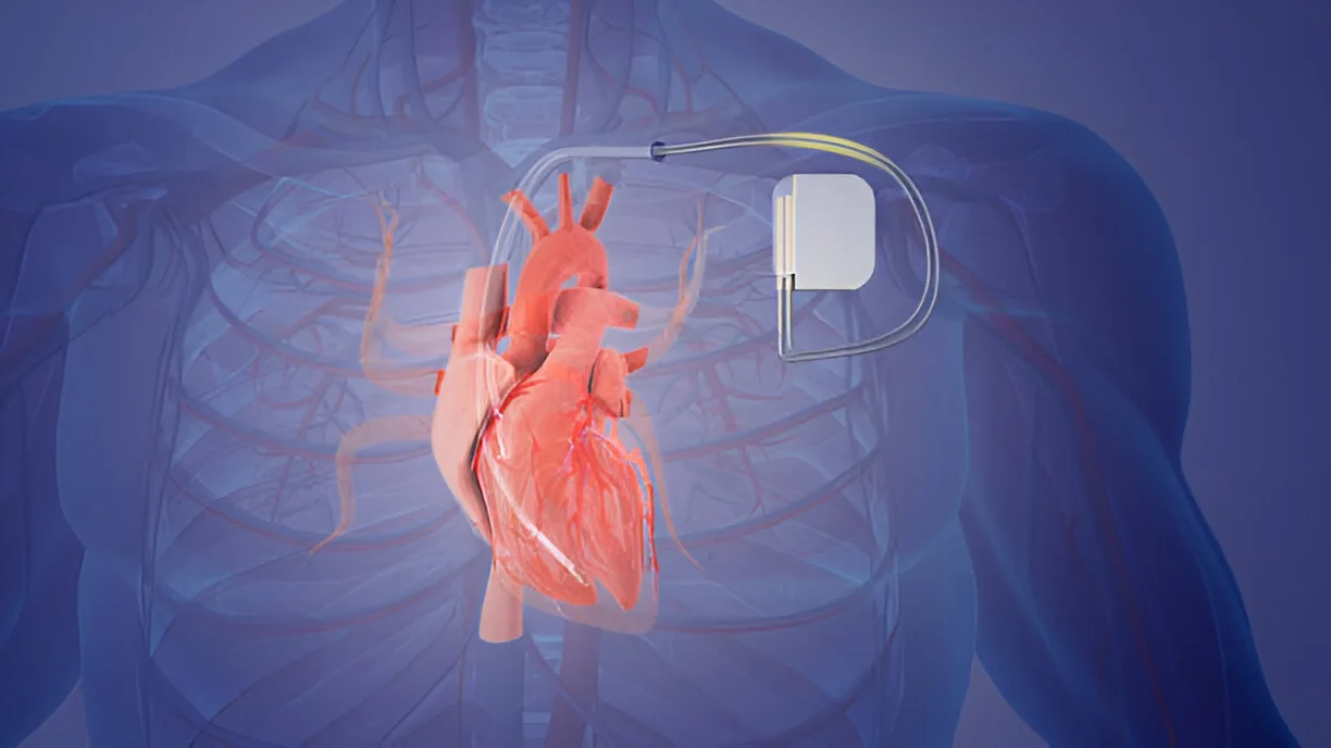Pacemakers in human body