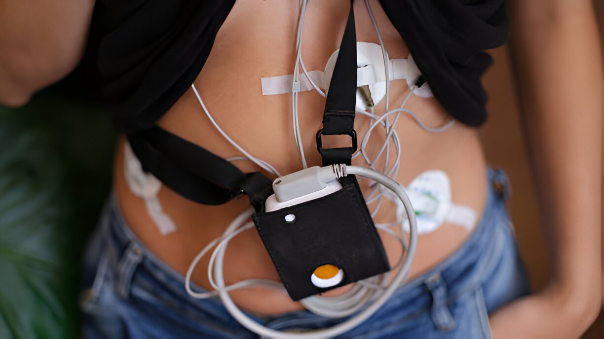 Display screen of the Holter monitoring screen