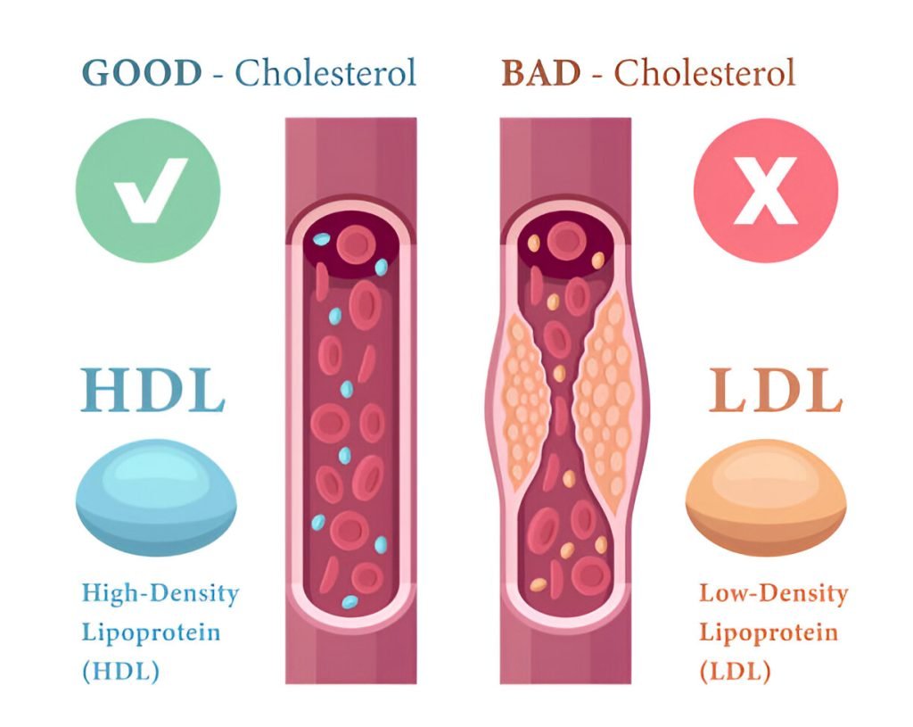 good and bad Cholesterol illustration