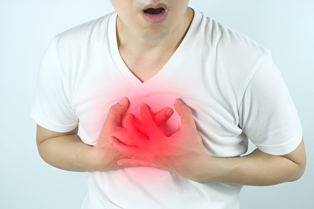 heart attack