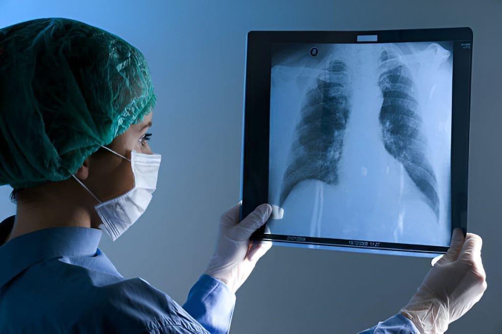 Female doctor looking at X-ray