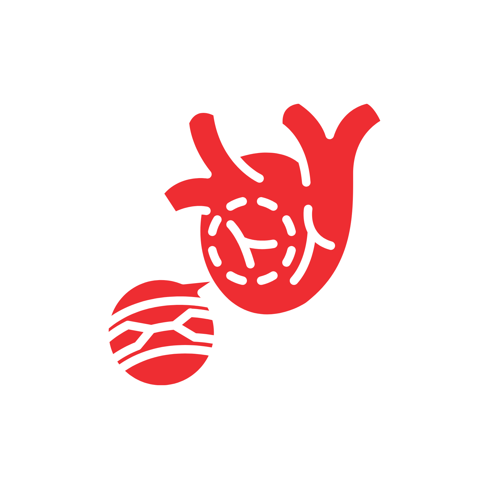 Narrowed or Blocked Coronary Arteries