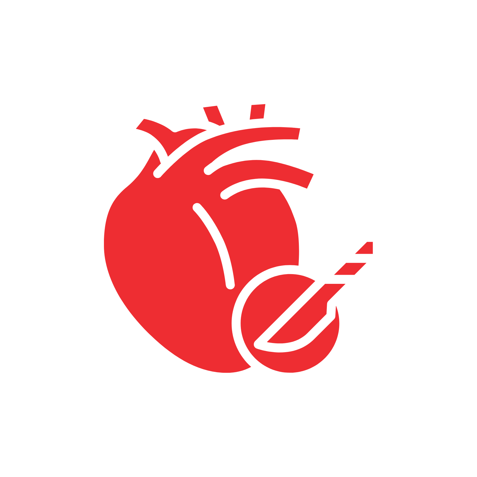 Coronary Angiography